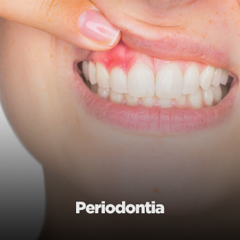 periodontia